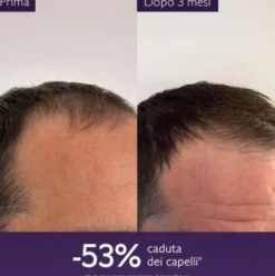 Caudalie Siero Capelli Anticaduta - Per la caduta dei capelli da stress, cambio di stagione o post-partum - 50 ml