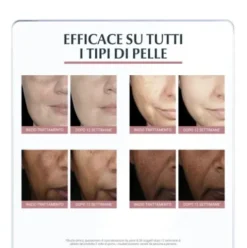 Eucerin Anti Pigment Correttore Antimacchie - Correttore viso contro le macchie scure - 5 ml