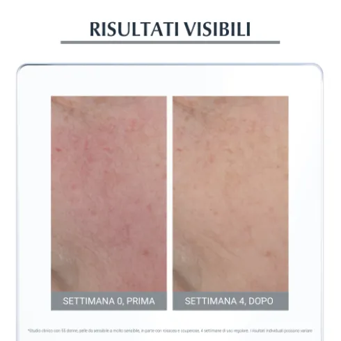 Eucerin Antirose Trattamento Giorno Neutralizzante SPF25 - Crema giorno per rosacea e couperose - 50 ml
