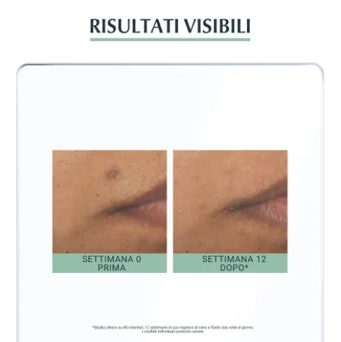 Eucerin Dermopurifyer Siero Tripla Azione - Siero anti macchie da acne, anti imperfezioni ed anti lucidità - 40 ml