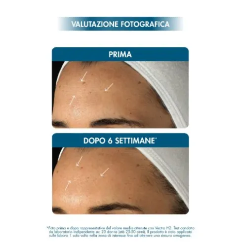 Miamo Hyaluron14+ Fusion Serum - Siero viso rimpolpante anti-rughe - 10 ml