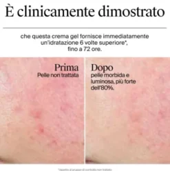 Neutrogena Hydro Boost Crema-Gel - Crema viso idratante per pelle secca e sensibile - 50 ml